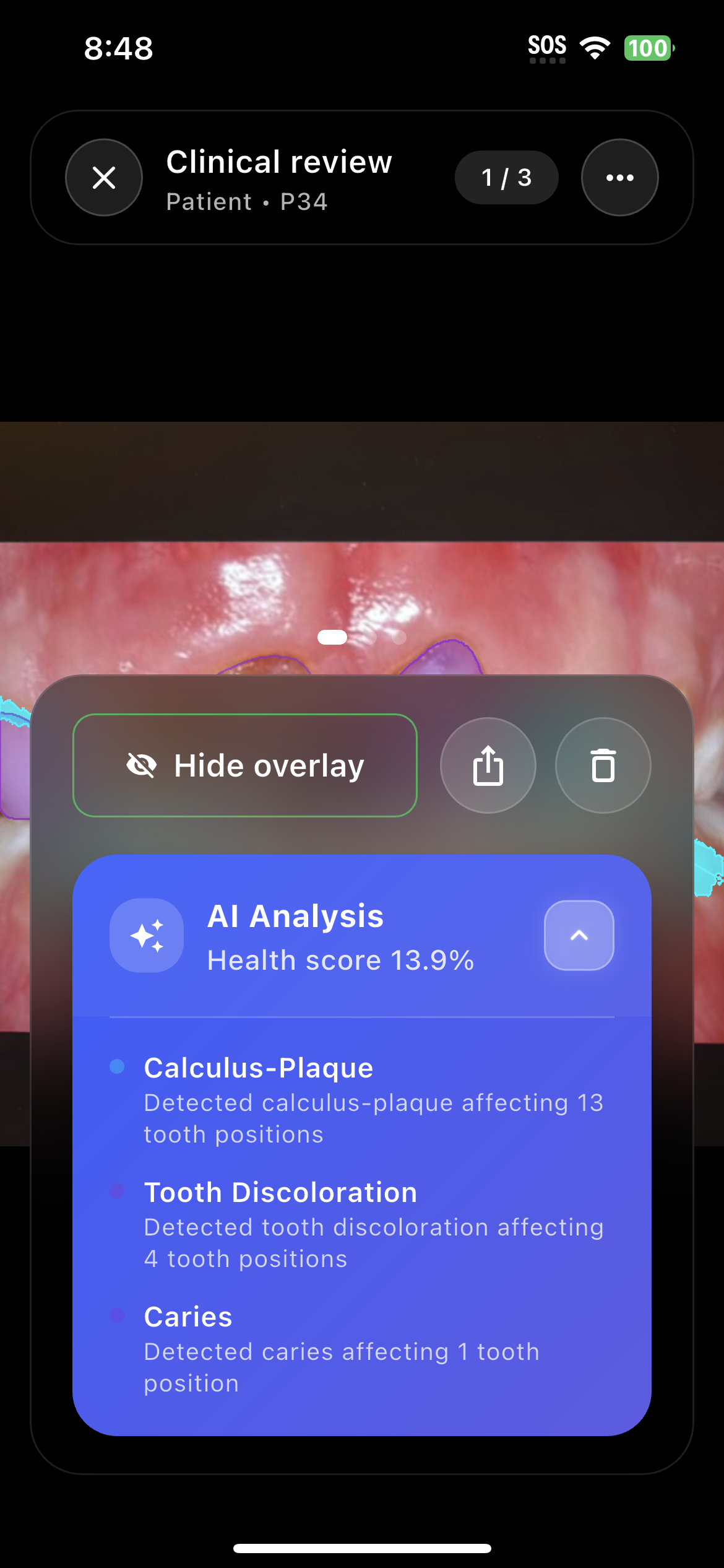 Detailed AI Results